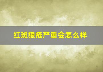 红斑狼疮严重会怎么样