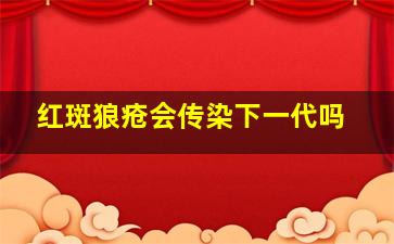 红斑狼疮会传染下一代吗