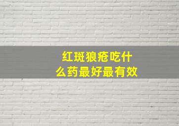 红斑狼疮吃什么药最好最有效