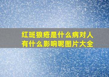 红斑狼疮是什么病对人有什么影响呢图片大全