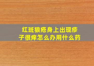 红斑狼疮身上出现疹子很痒怎么办用什么药