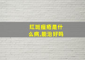 红斑痤疮是什么病,能治好吗