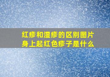 红疹和湿疹的区别图片身上起红色疹子是什么