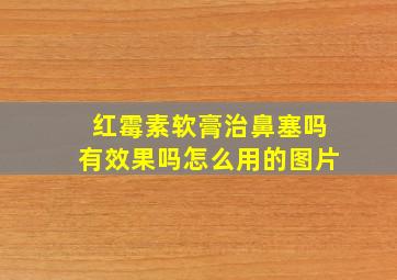 红霉素软膏治鼻塞吗有效果吗怎么用的图片