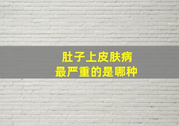 肚子上皮肤病最严重的是哪种