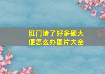 肛门堵了好多硬大便怎么办图片大全