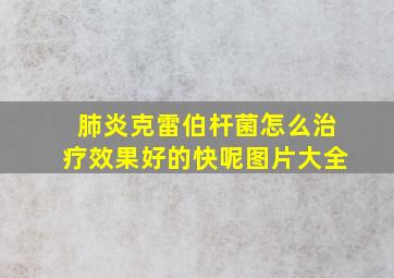 肺炎克雷伯杆菌怎么治疗效果好的快呢图片大全