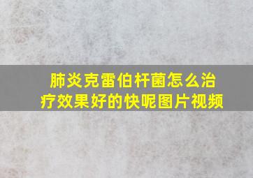 肺炎克雷伯杆菌怎么治疗效果好的快呢图片视频