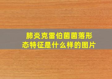 肺炎克雷伯菌菌落形态特征是什么样的图片