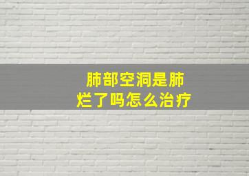 肺部空洞是肺烂了吗怎么治疗