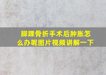 脚踝骨折手术后肿胀怎么办呢图片视频讲解一下