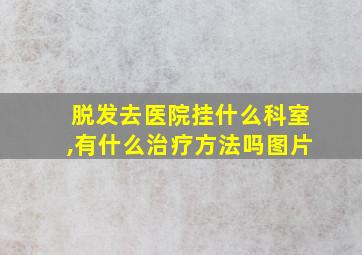 脱发去医院挂什么科室,有什么治疗方法吗图片