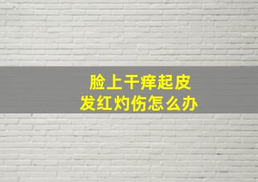 脸上干痒起皮发红灼伤怎么办