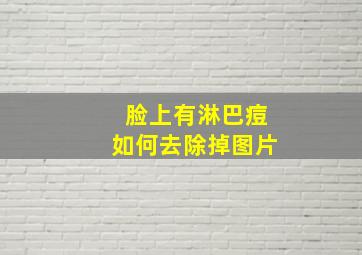 脸上有淋巴痘如何去除掉图片