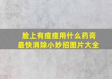 脸上有痘痘用什么药膏最快消除小妙招图片大全