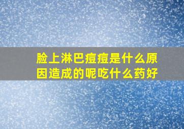 脸上淋巴痘痘是什么原因造成的呢吃什么药好