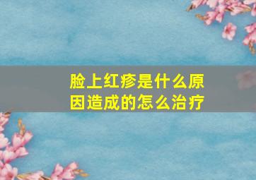 脸上红疹是什么原因造成的怎么治疗