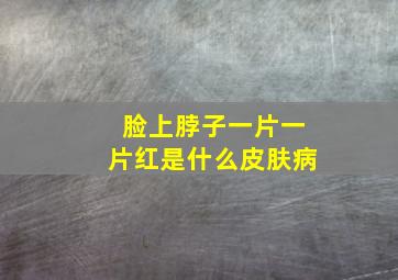 脸上脖子一片一片红是什么皮肤病