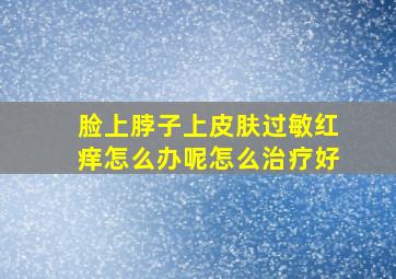 脸上脖子上皮肤过敏红痒怎么办呢怎么治疗好