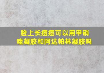 脸上长痘痘可以用甲硝唑凝胶和阿达帕林凝胶吗