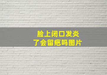 脸上闭口发炎了会留疤吗图片