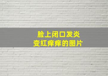 脸上闭口发炎变红痒痒的图片