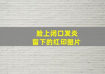 脸上闭口发炎留下的红印图片