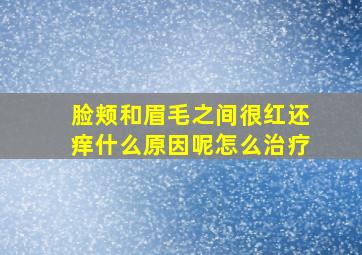 脸颊和眉毛之间很红还痒什么原因呢怎么治疗