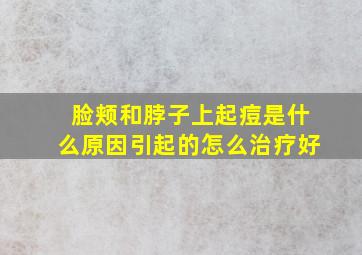 脸颊和脖子上起痘是什么原因引起的怎么治疗好