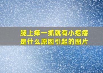 腿上痒一抓就有小疙瘩是什么原因引起的图片