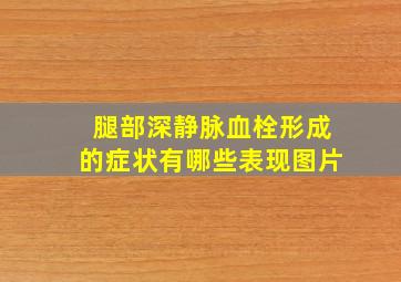 腿部深静脉血栓形成的症状有哪些表现图片