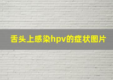 舌头上感染hpv的症状图片