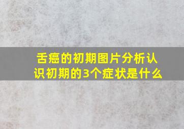 舌癌的初期图片分析认识初期的3个症状是什么