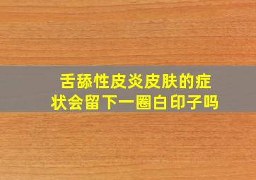 舌舔性皮炎皮肤的症状会留下一圈白印子吗