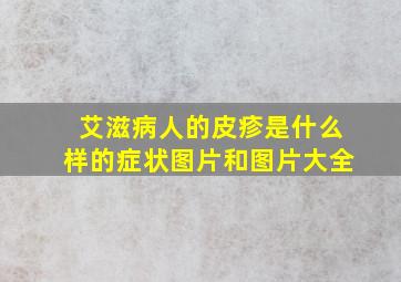 艾滋病人的皮疹是什么样的症状图片和图片大全