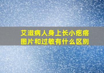 艾滋病人身上长小疙瘩图片和过敏有什么区别