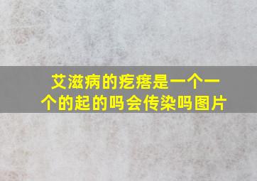 艾滋病的疙瘩是一个一个的起的吗会传染吗图片