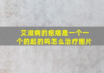 艾滋病的疙瘩是一个一个的起的吗怎么治疗图片