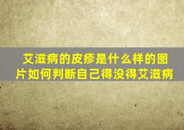 艾滋病的皮疹是什么样的图片如何判断自己得没得艾滋病