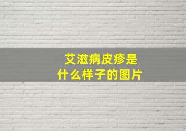 艾滋病皮疹是什么样子的图片