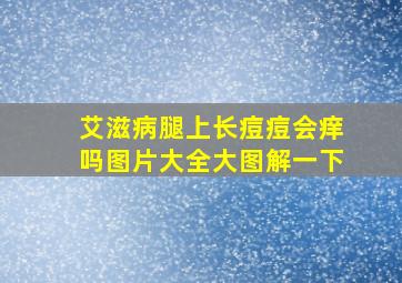 艾滋病腿上长痘痘会痒吗图片大全大图解一下