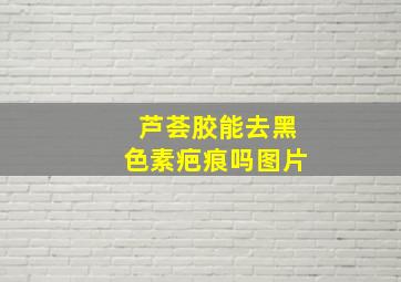 芦荟胶能去黑色素疤痕吗图片