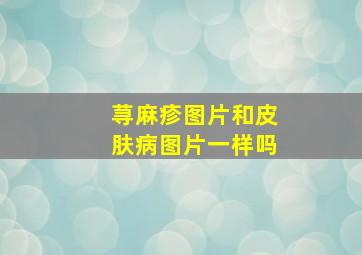 荨麻疹图片和皮肤病图片一样吗