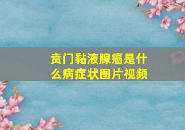 贲门黏液腺癌是什么病症状图片视频