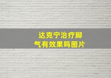 达克宁治疗脚气有效果吗图片