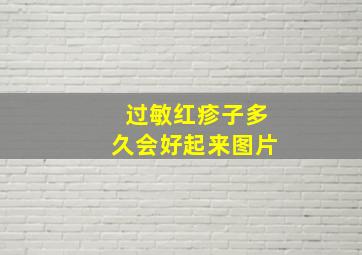 过敏红疹子多久会好起来图片