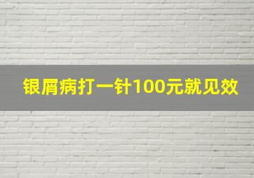 银屑病打一针100元就见效