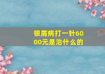 银屑病打一针6000元是治什么的