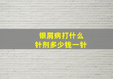 银屑病打什么针剂多少钱一针