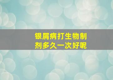 银屑病打生物制剂多久一次好呢